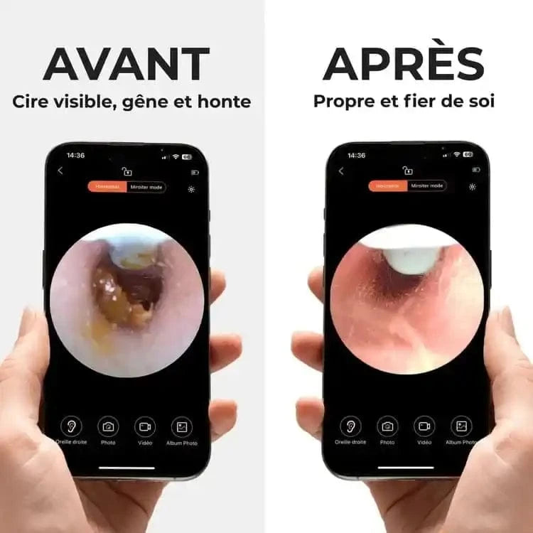 Earo™ Pro